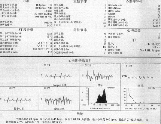 心律不齐（不良症状）