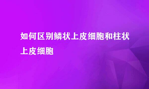 如何区别鳞状上皮细胞和柱状上皮细胞