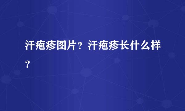 汗疱疹图片？汗疱疹长什么样？