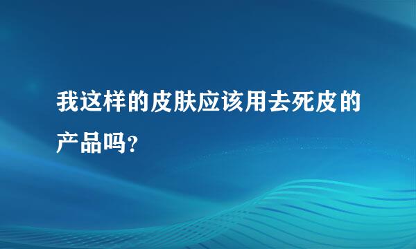 我这样的皮肤应该用去死皮的产品吗？