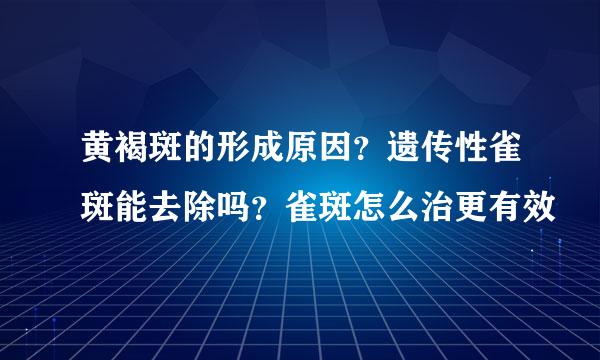 黄褐斑的形成原因？遗传性雀斑能去除吗？雀斑怎么治更有效