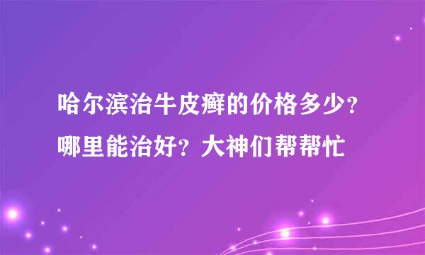 哈尔滨治牛皮癣的价格多少？哪里能治好？大神们帮帮忙