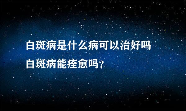 白斑病是什么病可以治好吗 白斑病能痊愈吗？