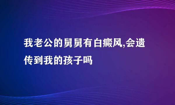 我老公的舅舅有白癜风,会遗传到我的孩子吗