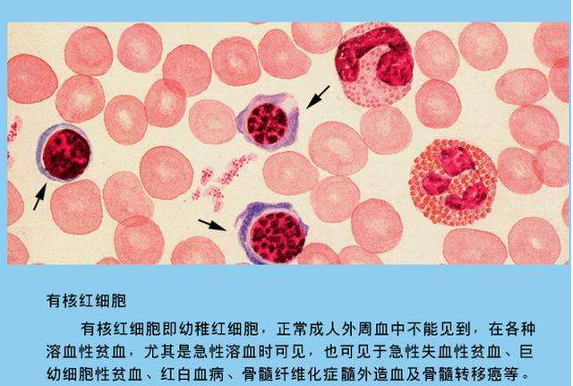 红细胞分布宽度正常系数应该是多少