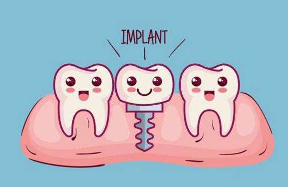 种植牙有什么利弊