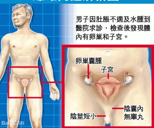 双性人是什么意思啊