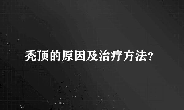 秃顶的原因及治疗方法？