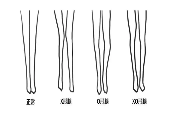 腿字拼音