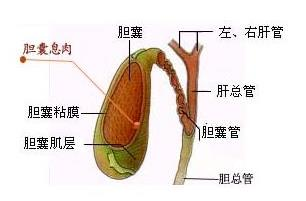 胆囊息肉最佳治疗方法？