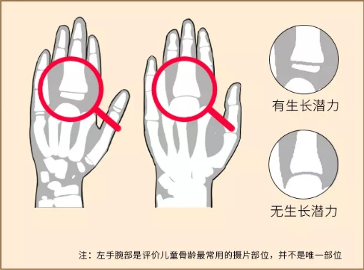 怎样快速在革事直丝一个月内长高10厘米