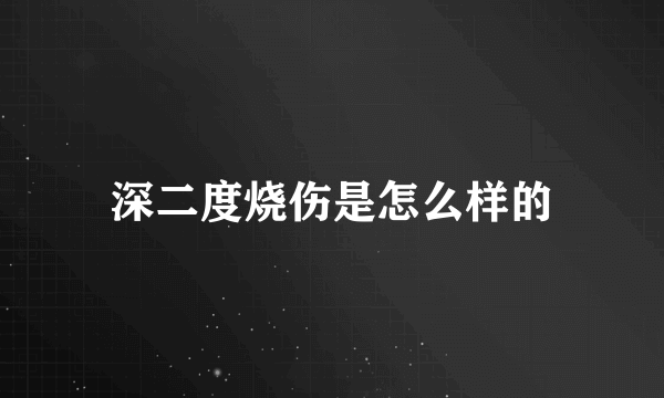 深二度烧伤是怎么样的