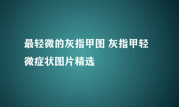 最轻微的灰指甲图 灰指甲轻微症状图片精选