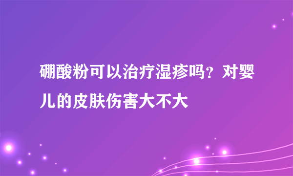 硼酸粉可以治疗湿疹吗？对婴儿的皮肤伤害大不大