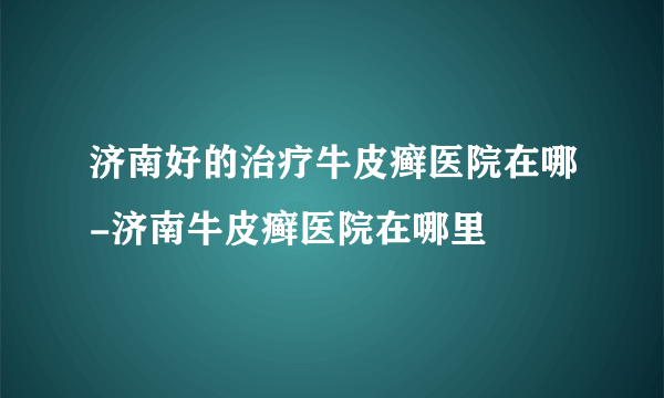 济南好的治疗牛皮癣医院在哪-济南牛皮癣医院在哪里