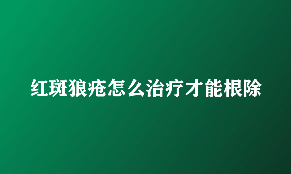 红斑狼疮怎么治疗才能根除