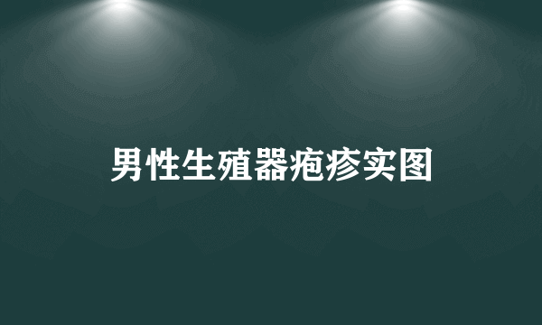 男性生殖器疱疹实图