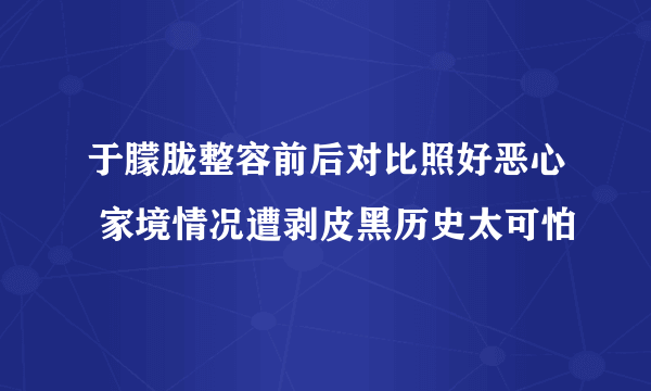 于朦胧整容前后对比照好恶心 家境情况遭剥皮黑历史太可怕