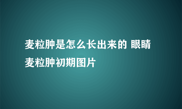 麦粒肿是怎么长出来的 眼睛麦粒肿初期图片