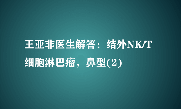 王亚非医生解答：结外NK/T细胞淋巴瘤，鼻型(2)