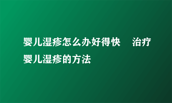 婴儿湿疹怎么办好得快    治疗婴儿湿疹的方法