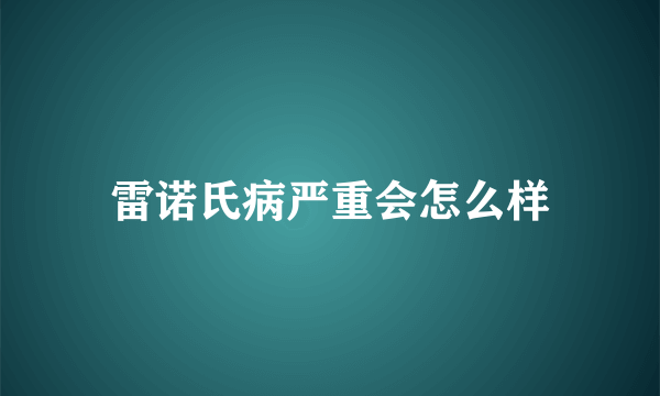 雷诺氏病严重会怎么样