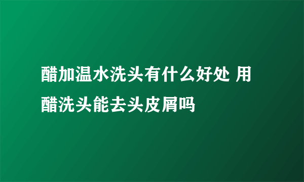 醋加温水洗头有什么好处 用醋洗头能去头皮屑吗