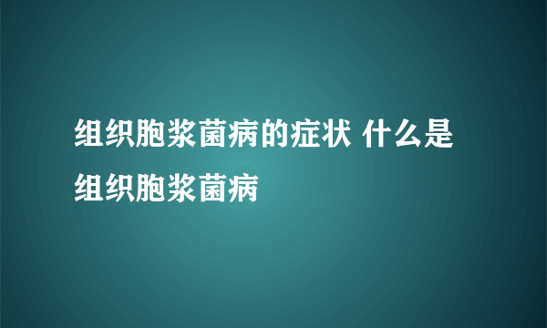 组织胞浆菌病的症状 什么是组织胞浆菌病