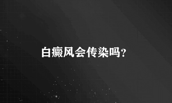 白癜风会传染吗？