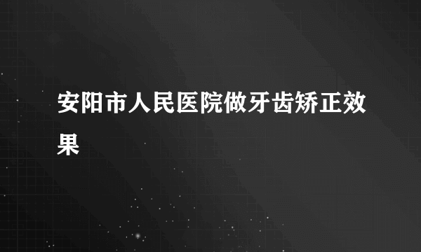 安阳市人民医院做牙齿矫正效果