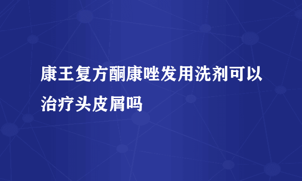 康王复方酮康唑发用洗剂可以治疗头皮屑吗