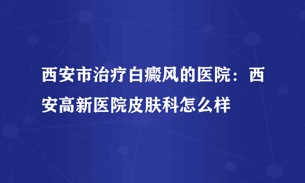 西安市治疗白癜风的医院：西安高新医院皮肤科怎么样