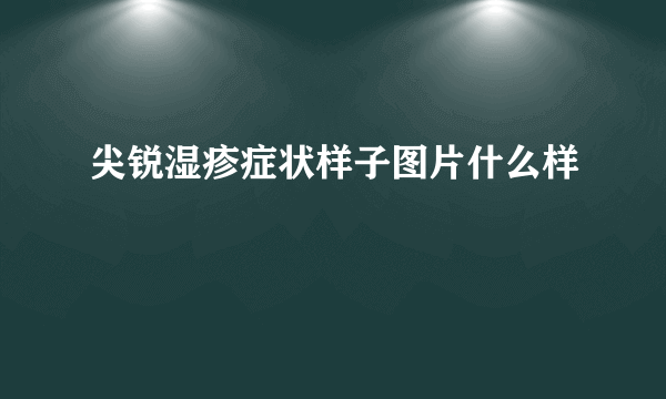 尖锐湿疹症状样子图片什么样