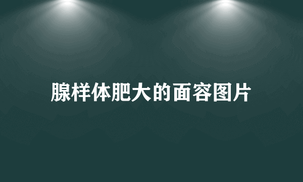 腺样体肥大的面容图片