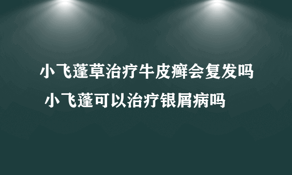 小飞蓬草治疗牛皮癣会复发吗 小飞蓬可以治疗银屑病吗