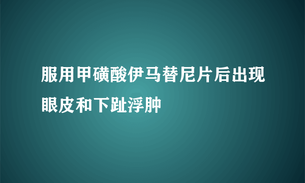 服用甲磺酸伊马替尼片后出现眼皮和下趾浮肿