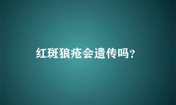 红斑狼疮会遗传吗？