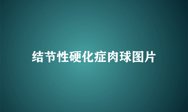 结节性硬化症肉球图片