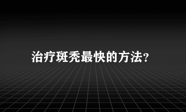 治疗斑秃最快的方法？