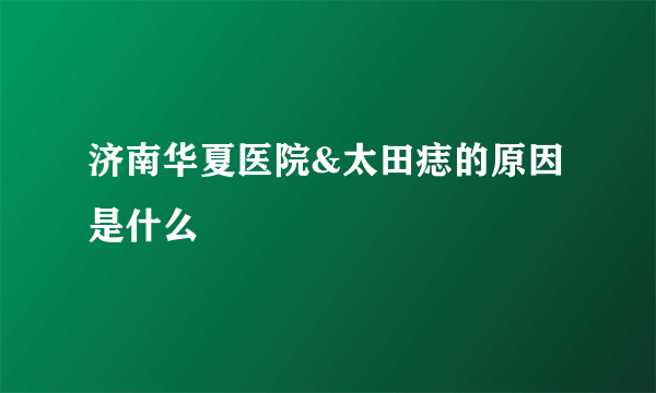 济南华夏医院&太田痣的原因是什么