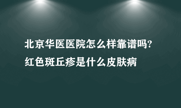 北京华医医院怎么样靠谱吗?红色斑丘疹是什么皮肤病