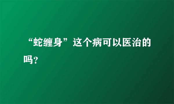 “蛇缠身”这个病可以医治的吗？