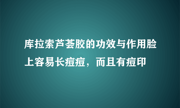 库拉索芦荟胶的功效与作用脸上容易长痘痘，而且有痘印