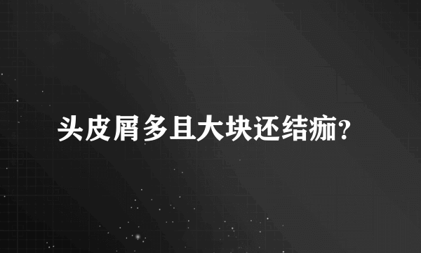 头皮屑多且大块还结痂？