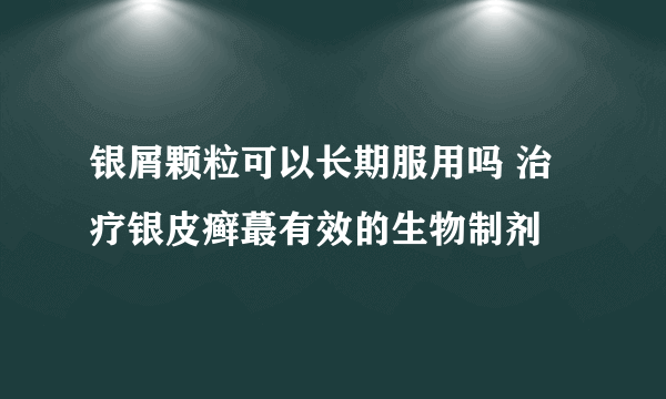 银屑颗粒可以长期服用吗 治疗银皮癣蕞有效的生物制剂