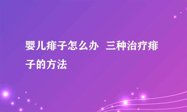 婴儿痱子怎么办  三种治疗痱子的方法