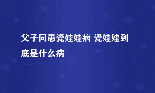 父子同患瓷娃娃病 瓷娃娃到底是什么病