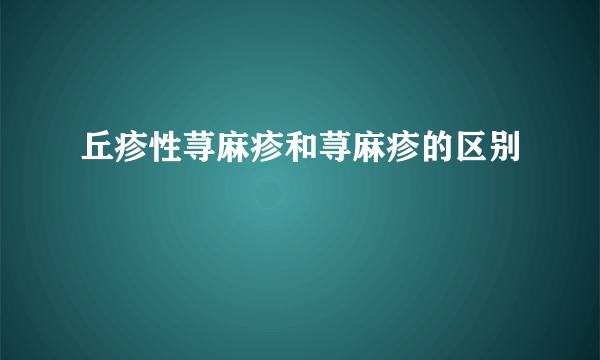 丘疹性荨麻疹和荨麻疹的区别