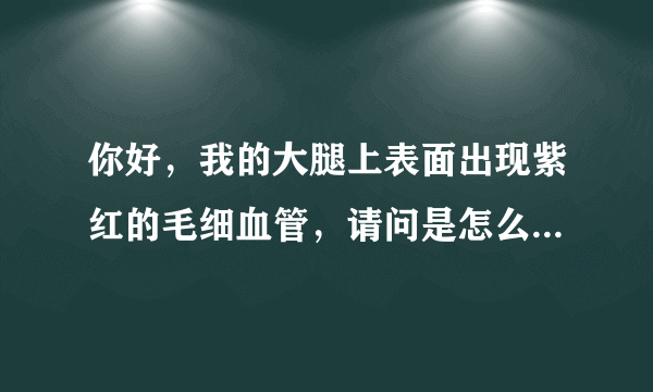 你好，我的大腿上表面出现紫红的毛细血管，请问是怎么...