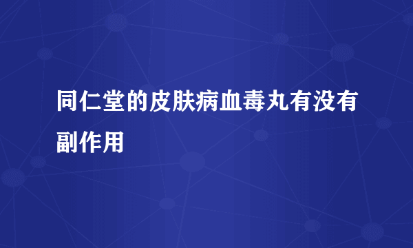 同仁堂的皮肤病血毒丸有没有副作用